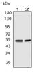Gamma-Aminobutyric Acid Type A Receptor Alpha1 Subunit antibody, PA1578, Boster Biological Technology, Western Blot image 