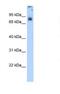 Cytochrome P450 Oxidoreductase antibody, NBP1-59779, Novus Biologicals, Western Blot image 