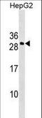 DNA Damage Inducible Transcript 4 Like antibody, LS-C159444, Lifespan Biosciences, Western Blot image 