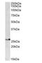 Proteasome Subunit Beta 4 antibody, NBP1-52080, Novus Biologicals, Western Blot image 