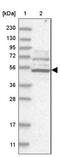 G Protein-Coupled Receptor 182 antibody, NBP1-90231, Novus Biologicals, Western Blot image 