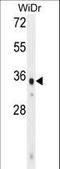 WD Repeat Domain 5B antibody, LS-C160596, Lifespan Biosciences, Western Blot image 