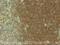 Major Histocompatibility Complex, Class I, E antibody, ab2216, Abcam, Immunohistochemistry paraffin image 