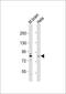 Dual Specificity Tyrosine Phosphorylation Regulated Kinase 1A antibody, GTX81398, GeneTex, Western Blot image 