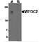 WAP Four-Disulfide Core Domain 2 antibody, MBS153572, MyBioSource, Western Blot image 