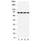 Transglutaminase 1 antibody, R31059, NSJ Bioreagents, Western Blot image 
