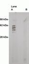 Sphingomyelin Synthase 2 antibody, MBS395636, MyBioSource, Western Blot image 