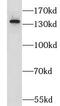 Glutamate Receptor Interacting Protein 1 antibody, FNab03650, FineTest, Western Blot image 