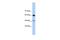 DAZ Associated Protein 1 antibody, A07947, Boster Biological Technology, Western Blot image 