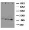 Cystatin B antibody, LS-C313226, Lifespan Biosciences, Western Blot image 