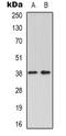 GRB2 Related Adaptor Protein 2 antibody, orb339037, Biorbyt, Western Blot image 