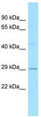 G Protein-Coupled Receptor 84 antibody, TA338025, Origene, Western Blot image 