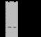 N(Alpha)-Acetyltransferase 10, NatA Catalytic Subunit antibody, GTX02240, GeneTex, Western Blot image 