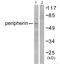 Peripherin antibody, A06787, Boster Biological Technology, Western Blot image 