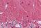 Tubulin alpha-3C/D chain antibody, MBS245652, MyBioSource, Immunohistochemistry paraffin image 