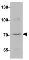 Leucine Zipper Tumor Suppressor 2 antibody, GTX31845, GeneTex, Western Blot image 
