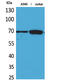 X-Ray Repair Cross Complementing 6 antibody, STJ96698, St John