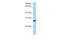 MAX Dimerization Protein MLX antibody, 30-739, ProSci, Western Blot image 