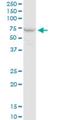 Protein Phosphatase 2 Scaffold Subunit Aalpha antibody, H00005518-M02, Novus Biologicals, Western Blot image 