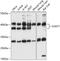 SGT1 Homolog, MIS12 Kinetochore Complex Assembly Cochaperone antibody, 15-260, ProSci, Western Blot image 