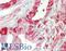 Transglutaminase 4 antibody, LS-B11180, Lifespan Biosciences, Immunohistochemistry paraffin image 