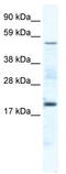 Casein Kinase 1 Gamma 1 antibody, TA329604, Origene, Western Blot image 