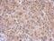 Hypoxia Inducible Factor 1 Subunit Alpha Inhibitor antibody, PA5-34852, Invitrogen Antibodies, Immunohistochemistry frozen image 