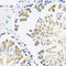 Calmodulin antibody, A31118, Boster Biological Technology, Immunohistochemistry paraffin image 