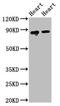 Aconitase 2 antibody, CSB-PA859943LA01HU, Cusabio, Western Blot image 