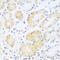 Complement C5 antibody, STJ110403, St John