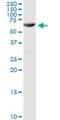 Amylase Alpha 1C (Salivary) antibody, H00000278-D01P, Novus Biologicals, Western Blot image 