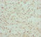 Reticulocalbin-2 antibody, LS-C676376, Lifespan Biosciences, Immunohistochemistry paraffin image 