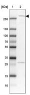 Leucine Rich Repeat Kinase 2 antibody, NBP2-48524, Novus Biologicals, Western Blot image 