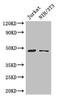 Serum/Glucocorticoid Regulated Kinase 1 antibody, CSB-PA021189LA01HU, Cusabio, Western Blot image 