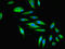 Zinc Finger FYVE-Type Containing 16 antibody, LS-C676739, Lifespan Biosciences, Immunofluorescence image 