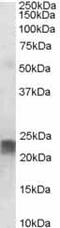 Transgelin antibody, ab10135, Abcam, Western Blot image 