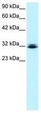 Retina And Anterior Neural Fold Homeobox antibody, ab23340, Abcam, Western Blot image 