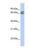 Decapping MRNA 1B antibody, NBP1-79422, Novus Biologicals, Western Blot image 