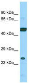 ADP Ribosylation Factor Like GTPase 6 Interacting Protein 4 antibody, TA331903, Origene, Western Blot image 