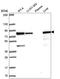 Hydroxyacyl-CoA Dehydrogenase Trifunctional Multienzyme Complex Subunit Alpha antibody, HPA056070, Atlas Antibodies, Western Blot image 