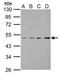 Abl Interactor 1 antibody, GTX111478, GeneTex, Western Blot image 