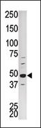 Cyclin Dependent Kinase 16 antibody, AP13816PU-N, Origene, Western Blot image 