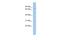 Meiosis Specific With Coiled-Coil Domain antibody, PA5-70024, Invitrogen Antibodies, Western Blot image 