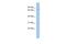 Meiosis Specific With Coiled-Coil Domain antibody, PA5-70024, Invitrogen Antibodies, Western Blot image 