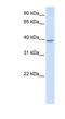 Kelch Domain Containing 2 antibody, NBP1-55419, Novus Biologicals, Western Blot image 