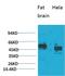 C-X-C Motif Chemokine Receptor 4 antibody, STJ97564, St John