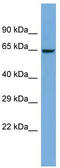 Zinc Finger Protein 8 antibody, TA343398, Origene, Western Blot image 