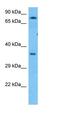 KH Domain Containing 4, Pre-MRNA Splicing Factor antibody, orb325962, Biorbyt, Western Blot image 