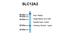 Solute Carrier Family 12 Member 2 antibody, NBP1-59430, Novus Biologicals, Western Blot image 