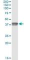 Complement Component 4 Binding Protein Beta antibody, H00000725-M01, Novus Biologicals, Immunoprecipitation image 